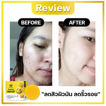 W Smiley Soap: Face Acne and Body Acne